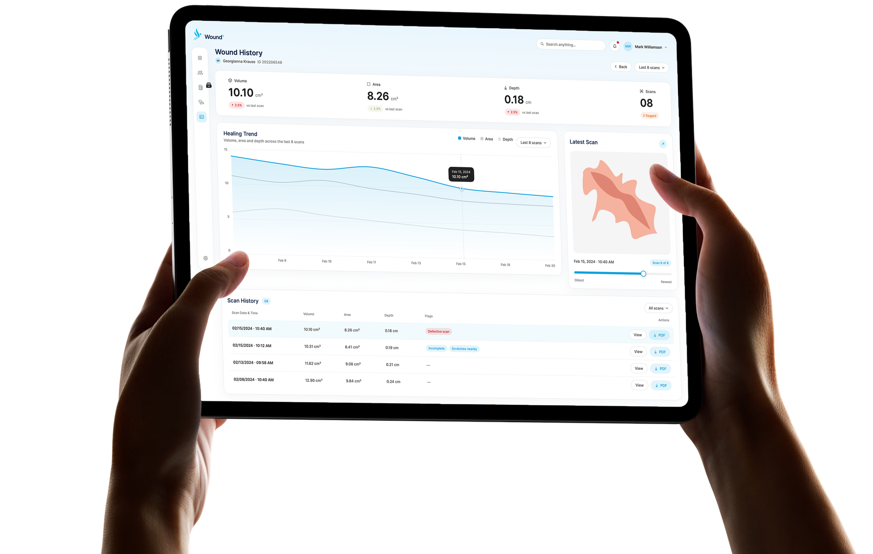 Hands holding a tablet showing the Wound³ dashboard